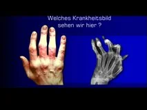 Loadmedical - Medizinische Filme - Crash-Kurs Medizin: Bewegungsapparat - Das komplette Video