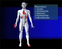 Loadmedical - Medizinische Filme - Crash-Kurs Medizin: Herz - Kreislauf - Blut - Das komplette Video