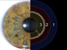Loadmedical - Medizinische Filme - Einführung in die Irisdiagnose