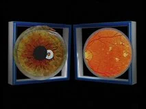 Loadmedical - Medizinische Filme - Die Praxis der Irisdiagnose