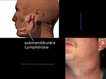 Loadmedical - Medizinische Filme - Die Blickdiagnose - Krankheitserkennung aus dem Gesicht