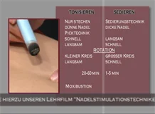 Loadmedical - Medizinische Filme - Die moderne energetische Akupunktur