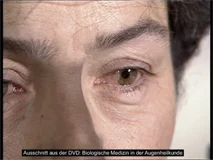 Loadmedical - Medizinische Filme - Crash-Kurs Medizin: Sinnesorgane - Das komplette Video