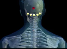 Loadmedical - Medizinische Filme - Einfache Neuraltherapie für die tägliche Praxis