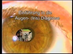 Einführung in die Irisdiagnose